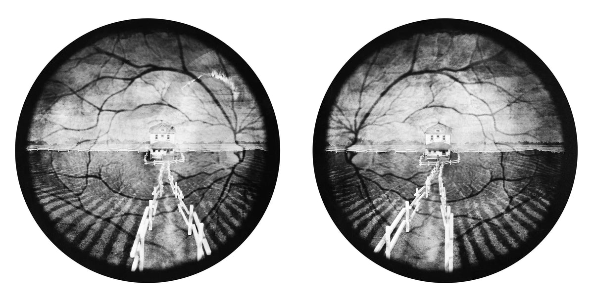 “Autorefractor No. 1” — photograph by Anthony Porcaro